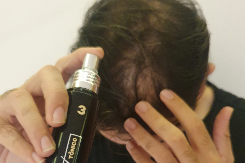 Tônico capilar para queda de cabelo